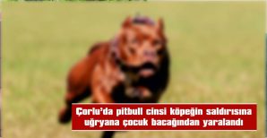 KÖPEĞİN SAHİBİ GÖZALTINA ALINDI